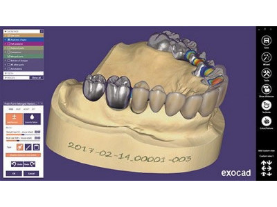 Протезирование зубов по технологии CAD-CAM